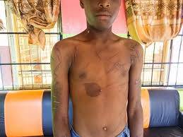 10-Year-Old Assault Victim Receiving Comprehensive Treatment, Confirms Anambra Commissioner