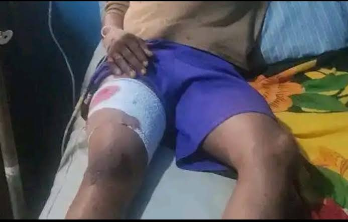 Osun Commissioner Arrested Over Gunshots at APC Rally