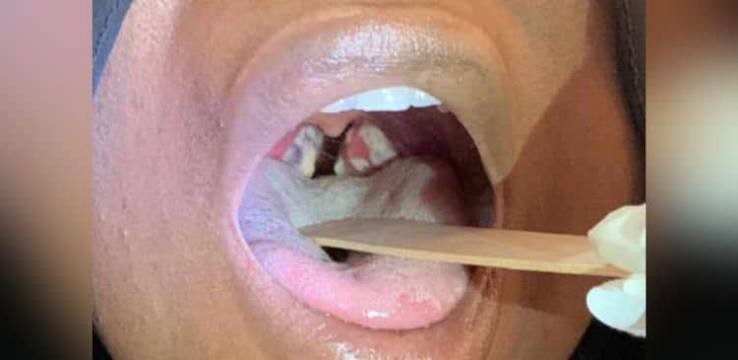 Kano Assembly Demands Urgent Intervention as Diphtheria Kills 50 Children