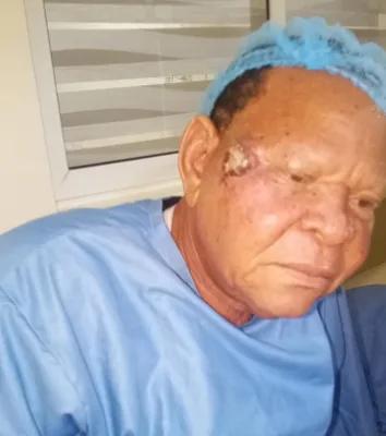 ANTP Debunks Cancer Rumours As Actor Wale Elesho Undergoes Facial Surgery