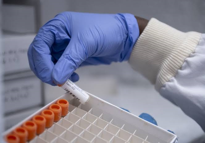 FG Hands Over Yaba Properties to Biovaccines Nigeria, Cementing Local Vaccine Production Push