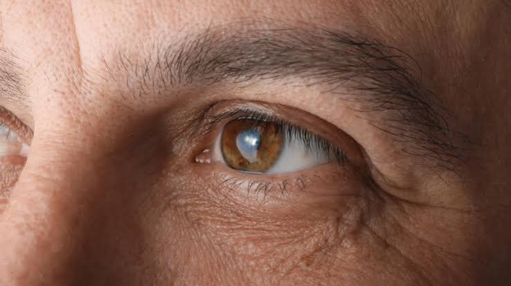 Tadalafil May Raise Glaucoma Risk, Study Finds