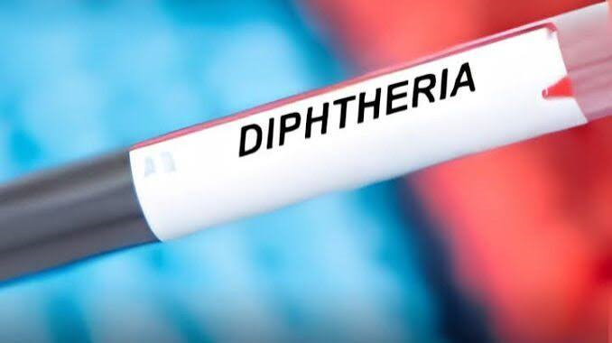 Plateau Records 469 Diphtheria Cases, 31 Deaths