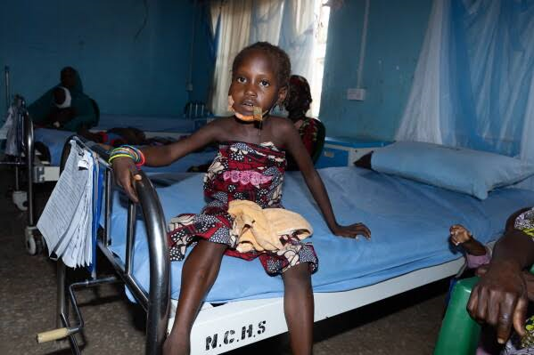 MSF Calls for Routine Noma Surveillance in Nigeria