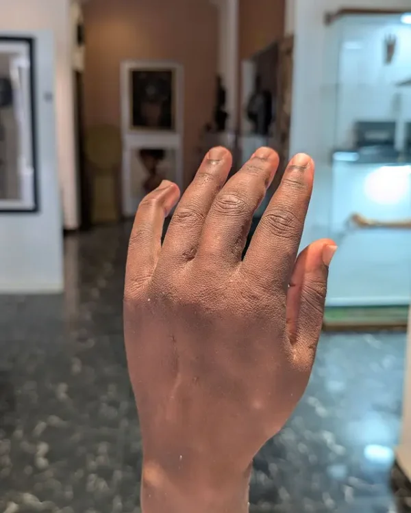 Nigerian-Made Bionic Arm Named Among TIME’s Best Inventions of 2026